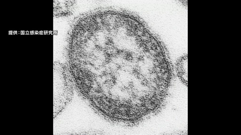 ワクチン未接種の0歳児海外から12月1日に入国　はしか感染　区役所職員150人に健康観察