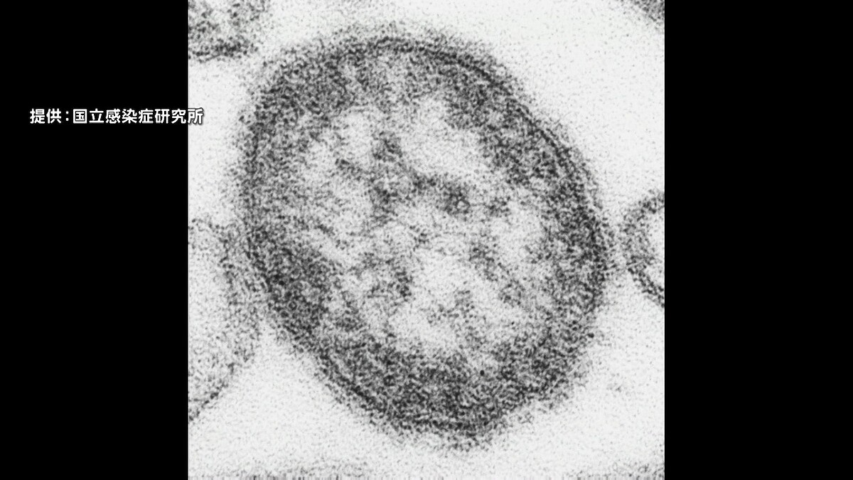 ワクチン未接種の0歳児海外から12月1日に入国　はしか感染　区役所職員150人に健康観察