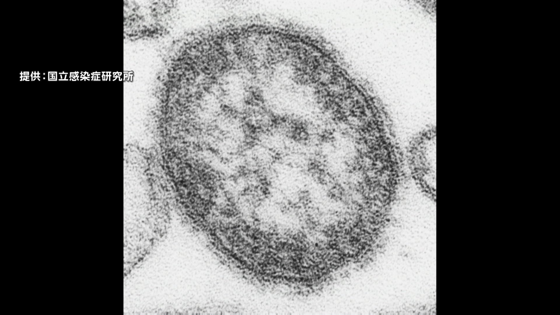 【感染症】0歳の男の子がはしか感染、区役所で接触した職員150人に健康観察 東京・台東区