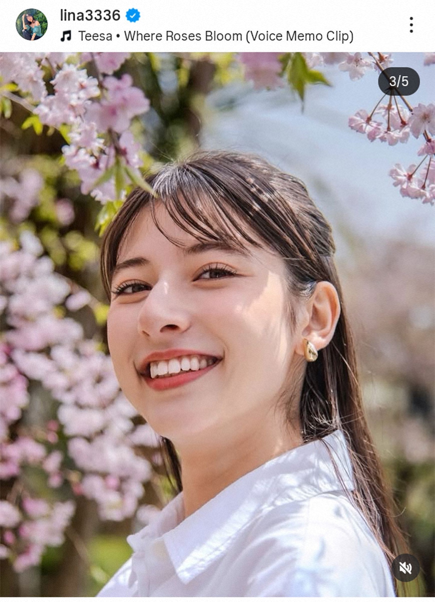 【芸能】城田優の妹でモデルの未来リナ 摂食障害に苦しんだことを明かす 1000個以上のルール、体重36キロに