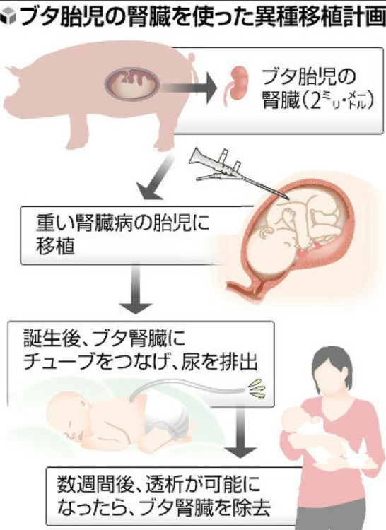 【国内初「異種移植」を慈恵医大など計画】ブタの腎臓を胎児に移植、透析までの「橋渡し」に…