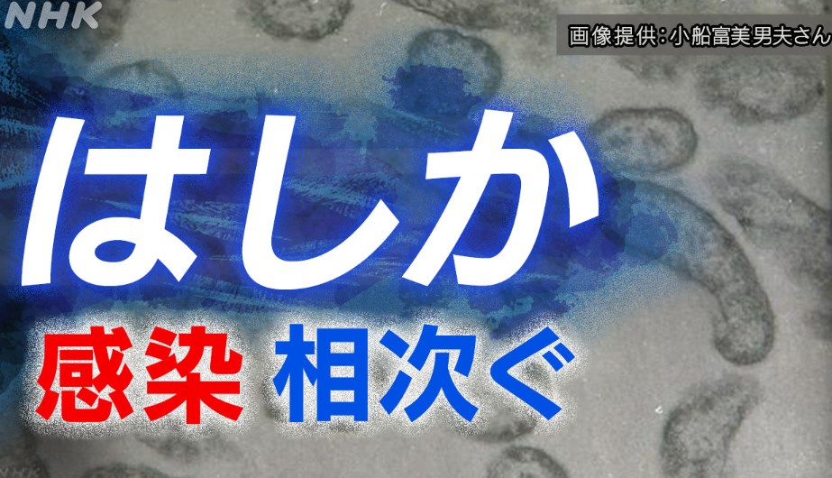 【解説】麻疹(はしか)の何がヤバいのか