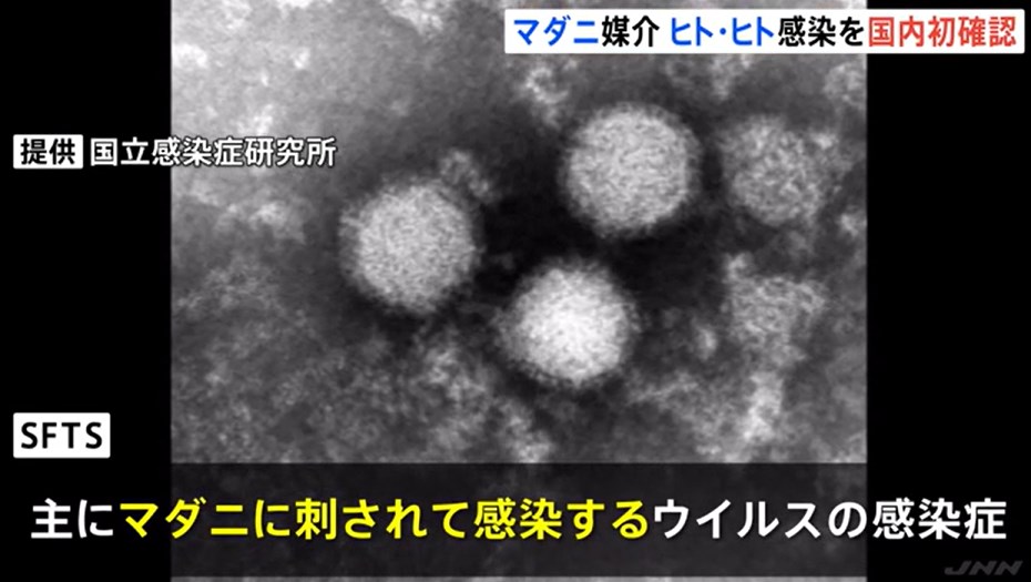 【マダニ感染症SFTS】ヒトからヒトへの感染を国内で初めて確認したと発表　感染したのは去年4月で発表は昨日