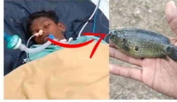 【インド】池で泳いでいた14歳少年にとんだ災難　魚が口の中に飛び込み緊急手術