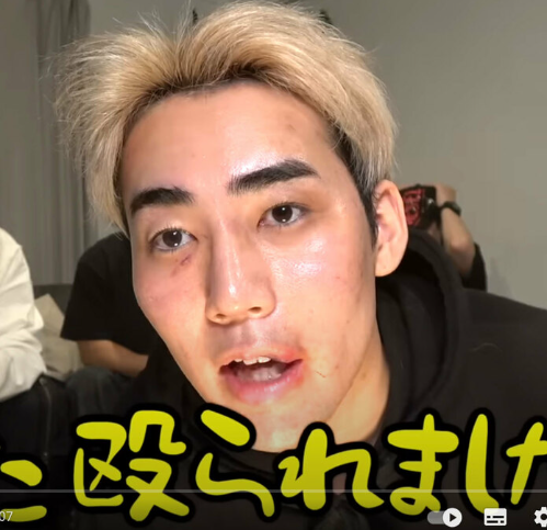 【YouTuber】高学歴YouTuber 登録者100万越えYouTuberに暴行を受け緊急搬送されたと告白「数字持ってから言えよって」