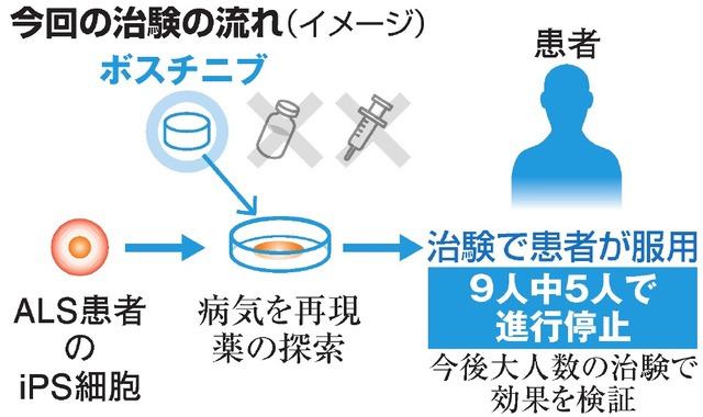 難病ALS　治験患者の半数以上で進行食い止め　白血病の薬「ボスチニブ」治験結果を発表　『世界初』めざすiPS研究所などの取り組み