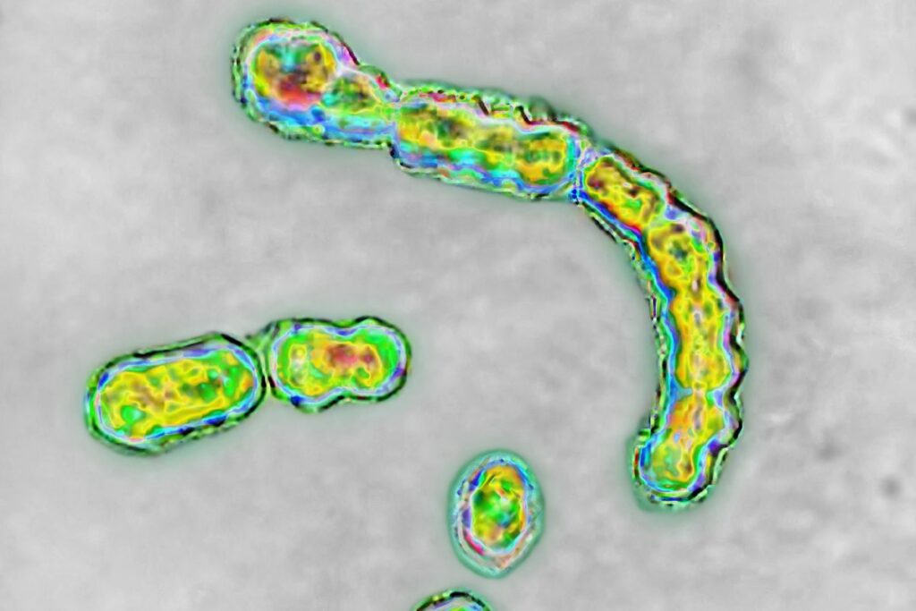 【溶連菌】人食いバクテリア　感染症が大流行中！傷口の消毒や手洗い・マスクが大事