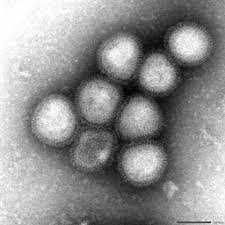 【中央日報】 「死亡率最大５０％の伝染病がくる…新型コロナ級の大流行、時間の問題」