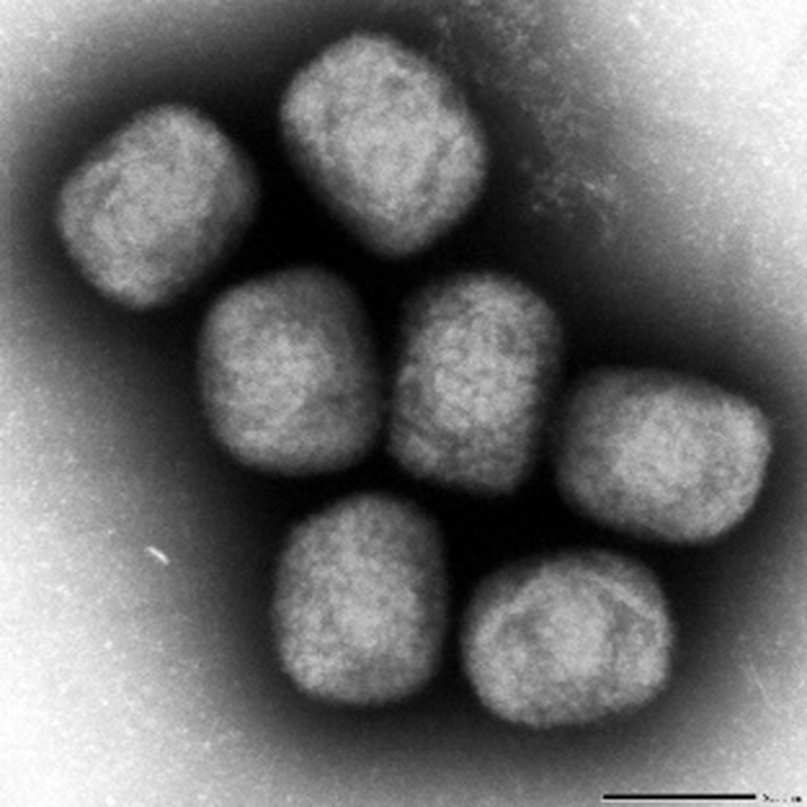 【台湾】エムポックスの感染者、新たに４人確認・・・４人は、いずれもワクチン接種の記録はなかった