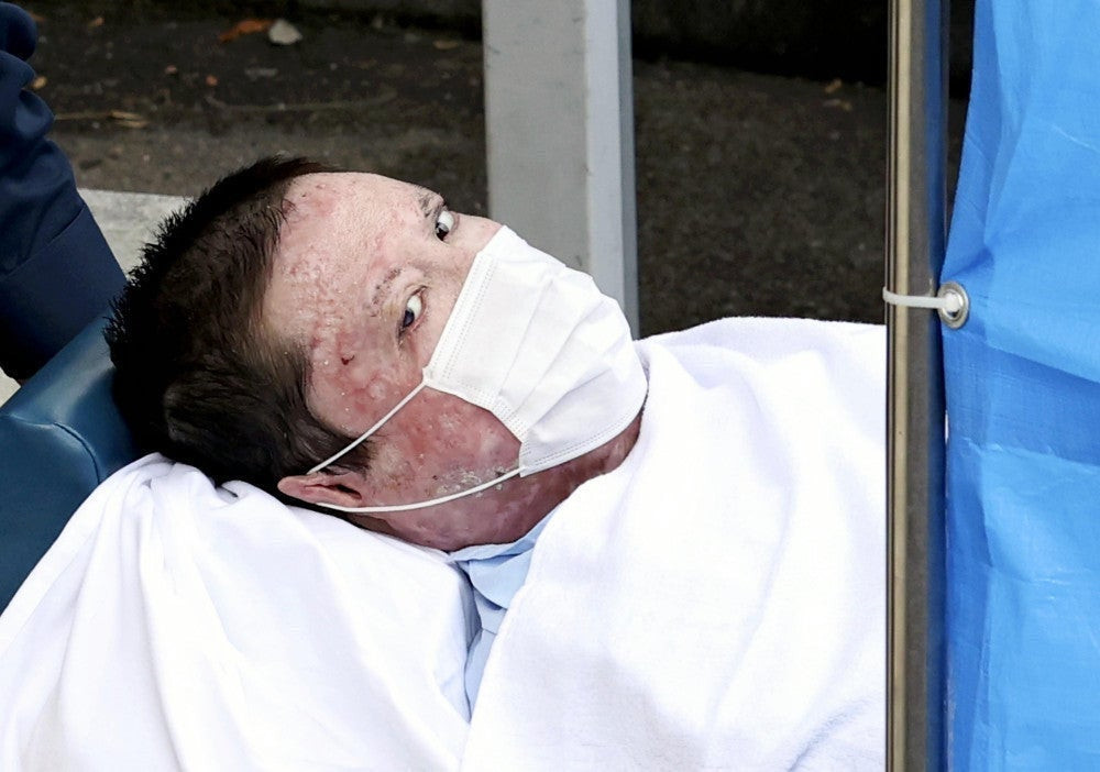 【5ch民】京アニ放火犯・青葉真司46歳、学生時代は撮り鉄だった