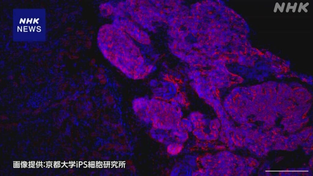AIがiPS細胞を肝臓に成長させる遺伝子を特定、いくらでも酒が飲める時代へ