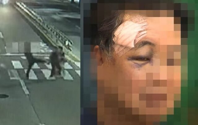 【韓国】「悪口が聞こえた気がした」だけで顔面キック→骨折…信じがたい路上暴行衝撃映像