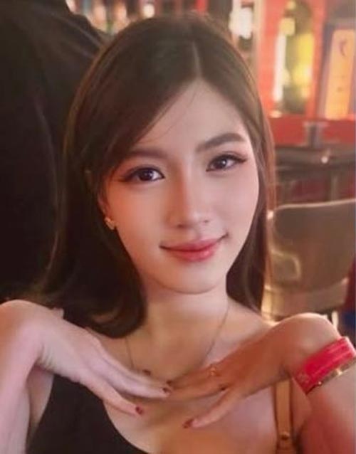 唇にヒアルロン酸注入したタイ人女性、施術後の写真が話題に