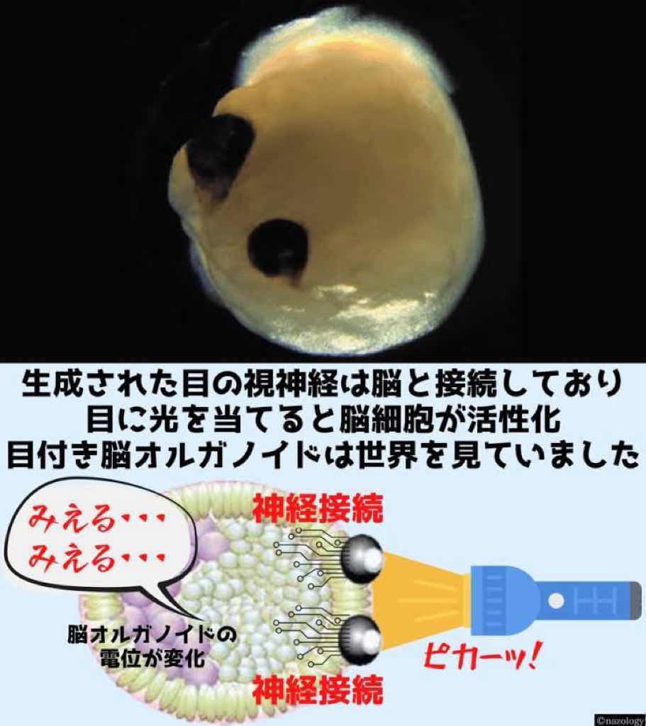 iPS細胞で　脳だけ人間誕生　目もあるよ（画像あり）