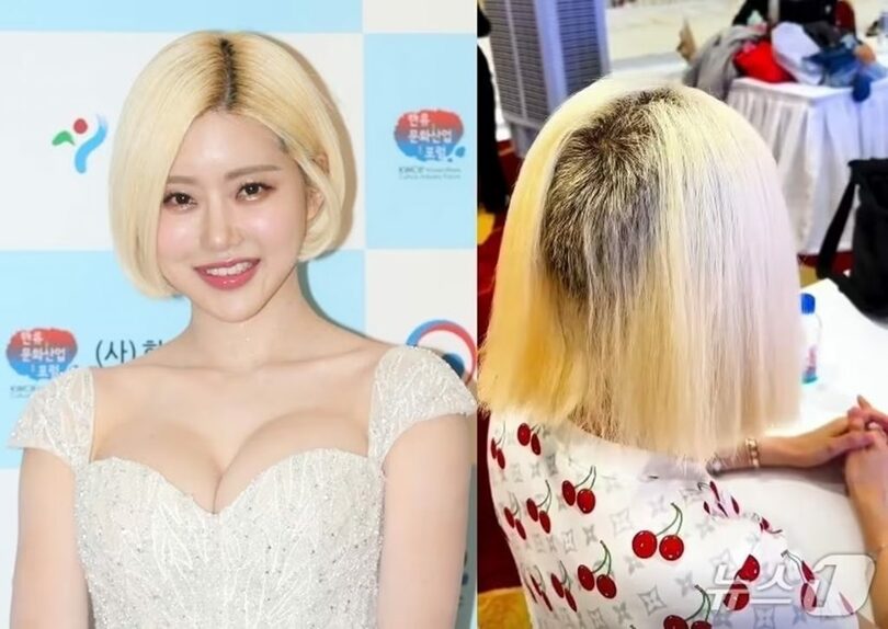 【韓国】 かの「韓国の著名DJ」が美容室トラブルを告白…脱色ミスで「髪が塊で抜けた」衝撃写真