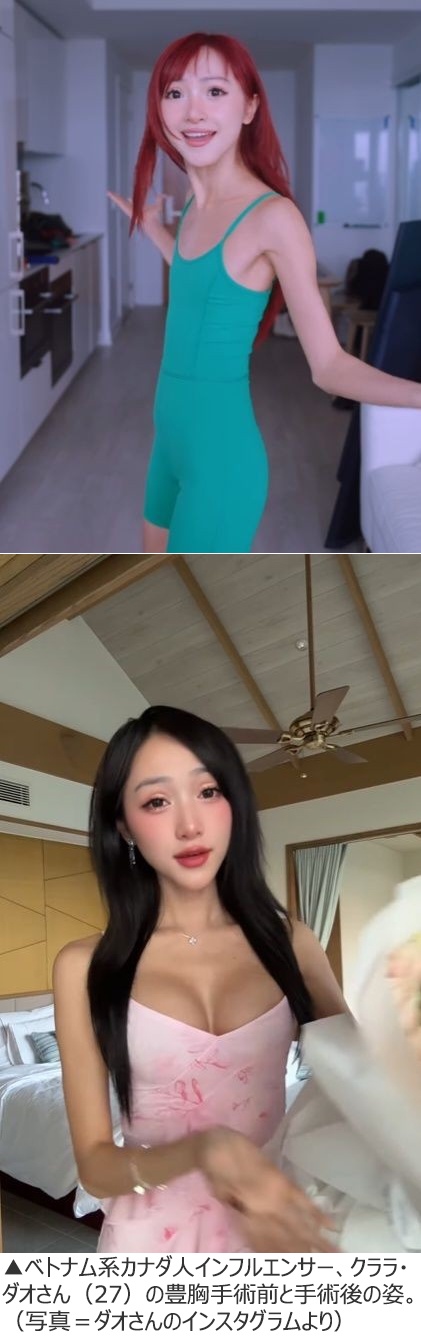 貧乳インフルエンサー「ありのままの私が好き。ボディポジティブ!!」→豊胸手術して炎上