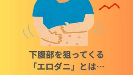 【害虫】下腹部を狙ってくる通称「エロダニ」目の周辺にまとわりつく「メマトイ」…何それ？！厄介な生き物の正体は？対策は？