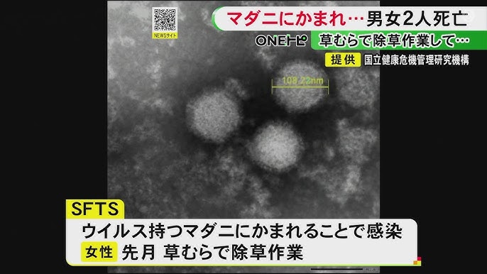 【愛知】マダニに噛まれた事が原因か…感染症『SFTS』で男女2人が死亡 うち1人は感染疑いの時期に草むら等での行動歴なし