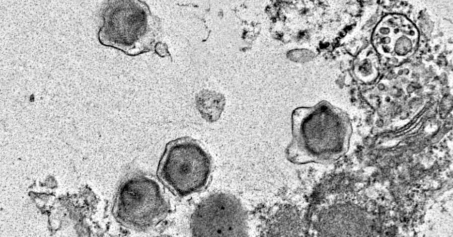 【生物学】世界各地の海から「未知の巨大ウイルス」230種類を発見