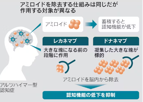 認知症薬、英での保険適用不可　レカネマブとドナネマブ　高額すぎて公的制度では提供できないと指摘