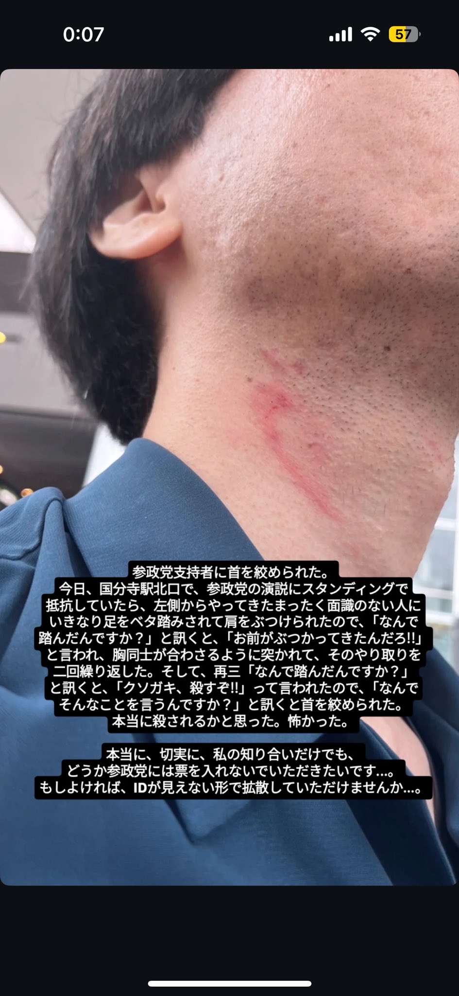 【悲報】参政党信者、抗議者の首を絞めて◯そうとして逮捕
