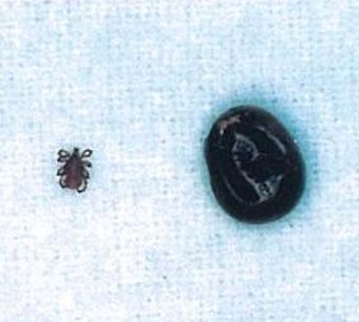 「致死性マダニ感染症」　急増の予想「発症者の９割以上がＡ型かＯ型」日本全国で重症例