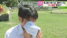 妻からカメムシ臭いって…」男性中心に悩み…30代半ばから発生“ミドル脂臭"原因は頭皮？