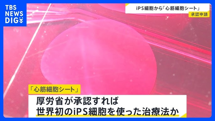 iPS細胞を使った世界初のパーキンソン病治療法･･･住友ファーマが承認申請