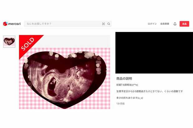 【X】メルカリに妊娠エコー写真　「闇深アイテム」大量出品にドン引き　「こんなの妊娠詐欺以外の何に使う？」