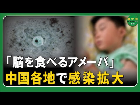【致死率98％】中国各地で 「脳を食べるアメーバ」 感染拡大