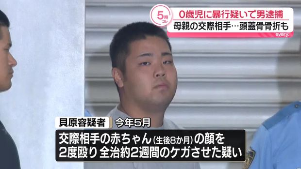 【東京】生後8カ月の赤ちゃんの顔を殴りけがさせたか、21歳男を逮捕「ごみ箱のごみを口に含もうとするのでやめさせようとしたが、言うことを聞かずイライラした」