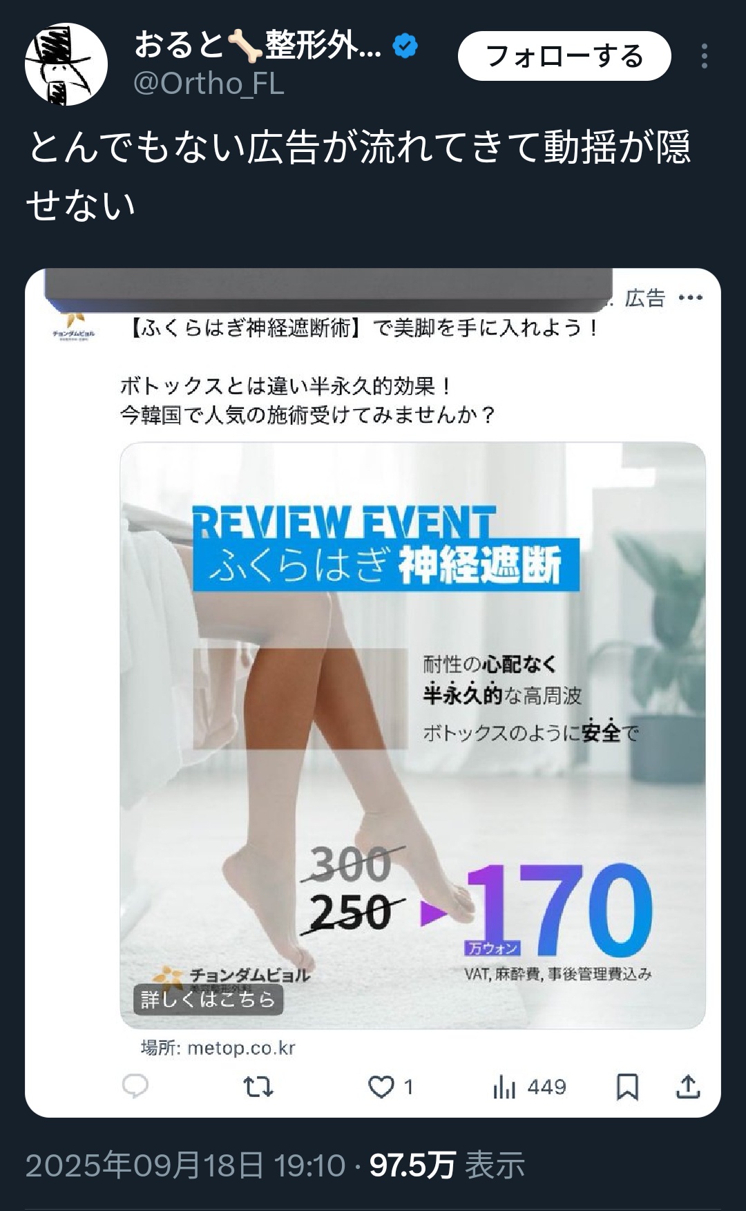 女さん、脚を細くしたいあまり「ふくらはぎの神経切断手術」を受けてしまう…