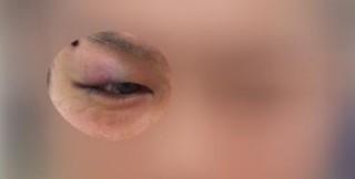 またもや大阪府警に家宅捜索中に暴行疑惑　“事件と無関係”男性が「捜査4課員に顔をひざ蹴りされた」　全治1カ月のけがで刑事告訴