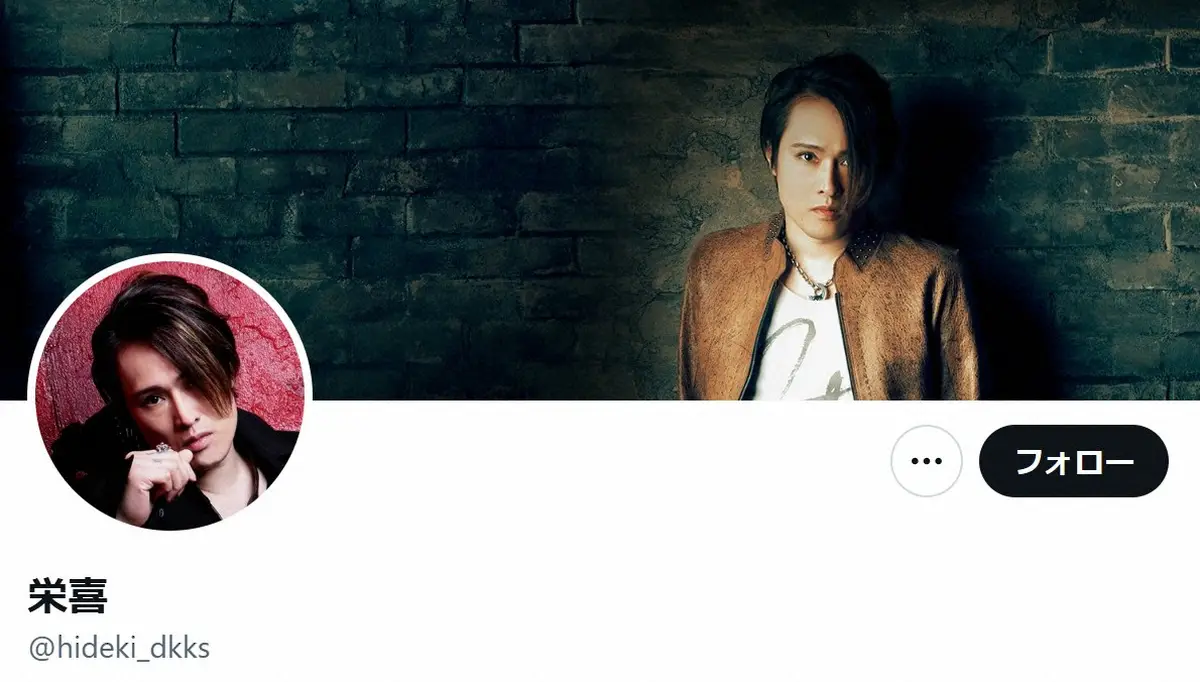 SIAM SHADEボーカル・栄喜、メンバー間の訴訟騒動に対してコメント発表「突然のことで困惑しており、整理ができていない」