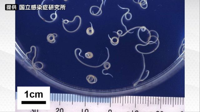 【仙台】飲食店で「アニサキス食中毒」刺身食べた男性の胃から寄生虫 一部停止処分に
