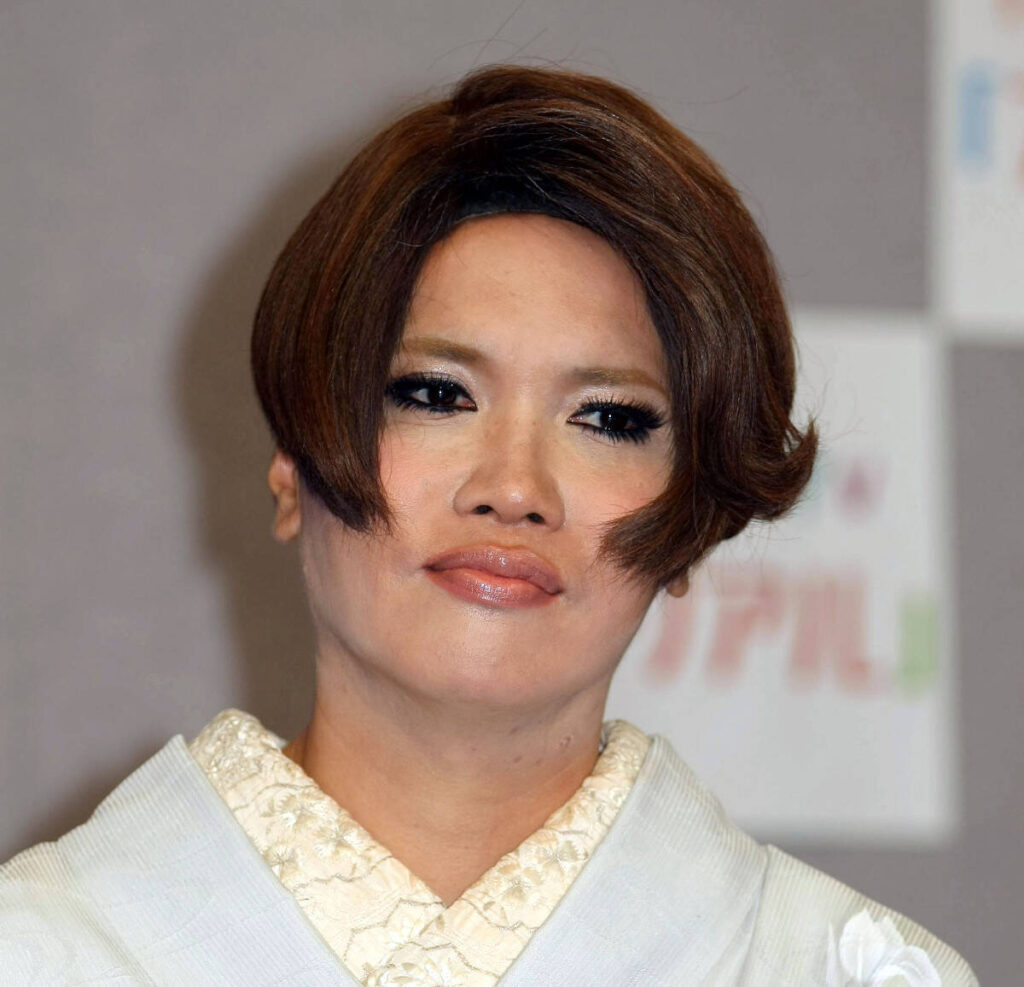 ＩＫＫＯ「末梢神経の顔面まひ」で緊急入院していた「眉毛の位置が２、３センチずれて…」退院と仕事復帰を報告