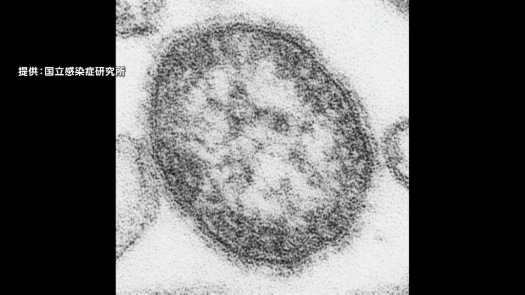 【感染症】0歳の男の子がはしか感染、区役所で接触した職員150人に健康観察 東京・台東区