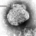 宝塚歌劇団が“はしか”感染に注意呼びかけ…1月20日の東京公演を“はしか”との診断受けた観客が観劇