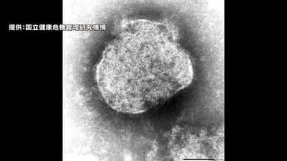 宝塚歌劇団が“はしか”感染に注意呼びかけ…1月20日の東京公演を“はしか”との診断受けた観客が観劇