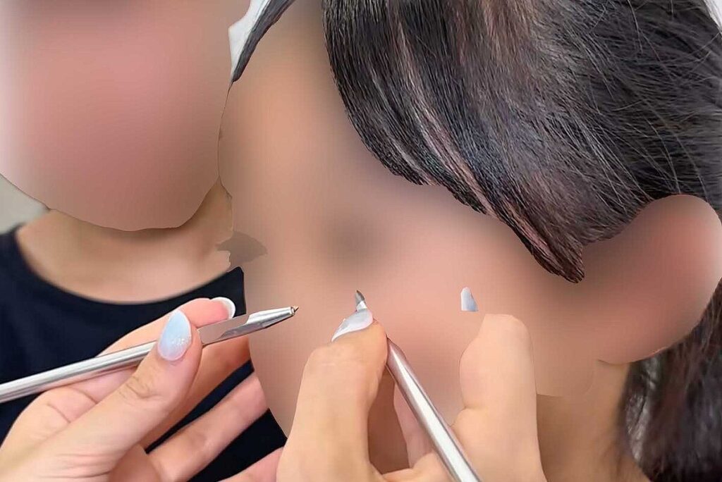 【話題】「10歳で整形って正気か？」美容クリニック公開の女児の二重整形動画に「デジタルタトゥー」の懸念