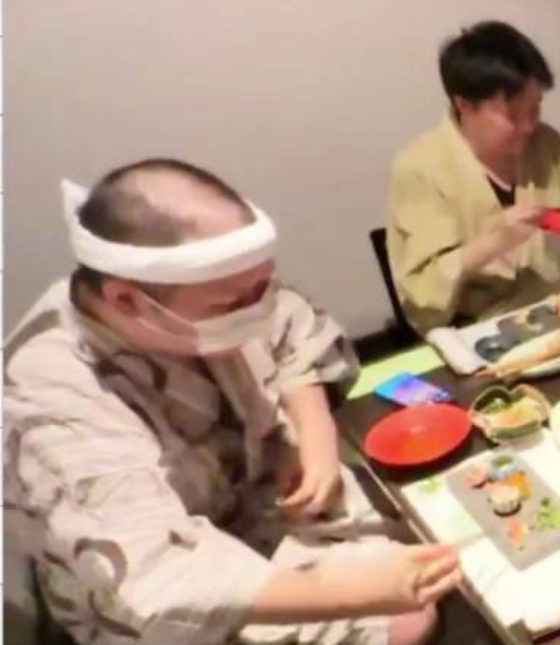 【画像】コレコレさん、クールポコみたいにハゲるww