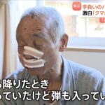 【悲報】猟友会のハンター(80)、クマの急襲に遭い顔面を咬まれるも反撃して射殺