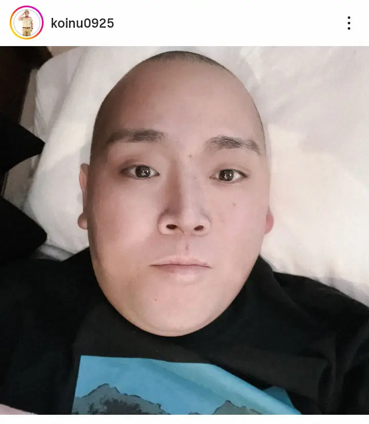 【芸能】 ステージ4の肝臓がんと闘う35歳元芸人が退院報告「完治まで頑張りたい」　今後は通院で抗がん剤治療へ