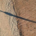 【国際】まるで中世の拷問…脚の骨を折って背を伸ばす「脚延長手術」を受ける男たちがトルコに殺到しているわけ