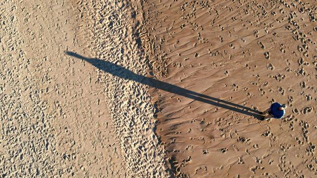 【国際】まるで中世の拷問…脚の骨を折って背を伸ばす「脚延長手術」を受ける男たちがトルコに殺到しているわけ