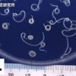 【仙台】飲食店で「アニサキス食中毒」刺身食べた男性の胃から寄生虫 一部停止処分に