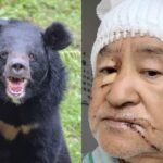 【クマ】〈「クマを殺すな」の抗議殺到も…〉頭皮をはがされ頭蓋骨がむきだしになった被害者男性が独白「あの凶暴性はやられないとわからない」