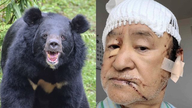 【クマ】〈「クマを殺すな」の抗議殺到も…〉頭皮をはがされ頭蓋骨がむきだしになった被害者男性が独白「あの凶暴性はやられないとわからない」
