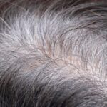 【東大】白髪が増えるのはがんを防ぐため…「白髪＝悪」の常識を覆す！