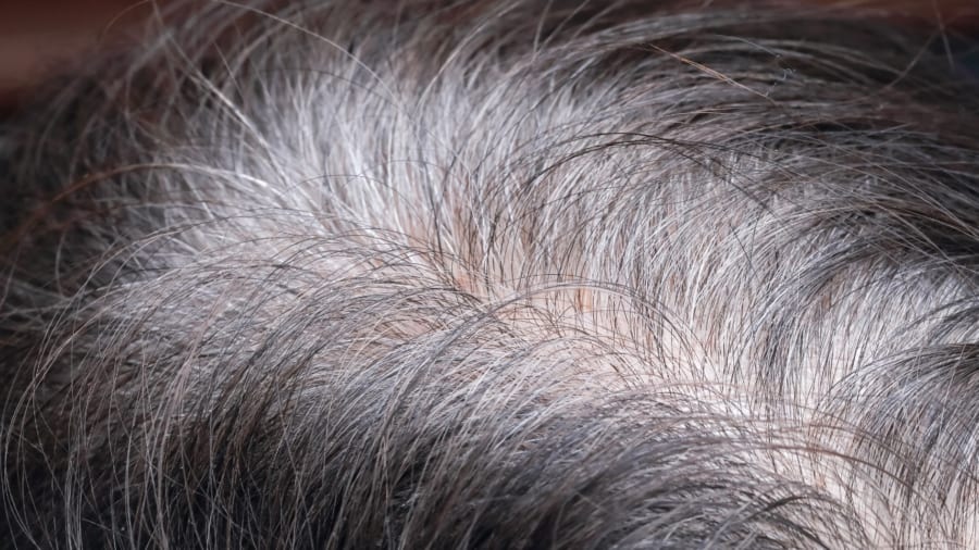 【東大】白髪が増えるのはがんを防ぐため…「白髪＝悪」の常識を覆す！